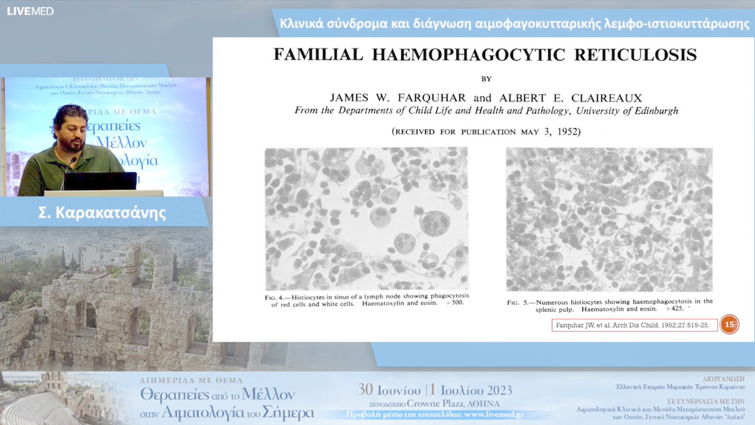 04 Σ. Καρακατσάνης - Κλινικά σύνδρομα και διάγνωση αιμοφαγoκυτταρικής λεμφο-ιστιοκυττάρωσης 