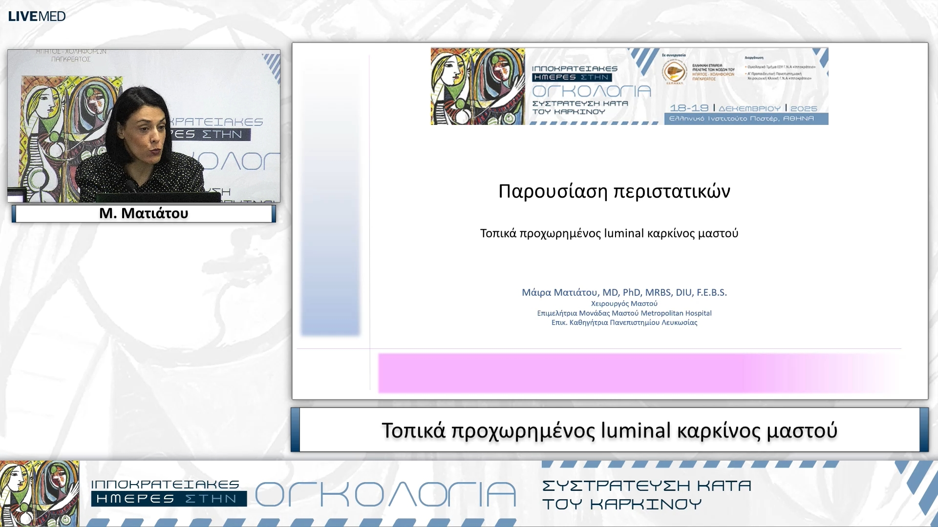 50 Μ. Ματιάτου - Τοπικά προχωρημένος luminal καρκίνος μαστού