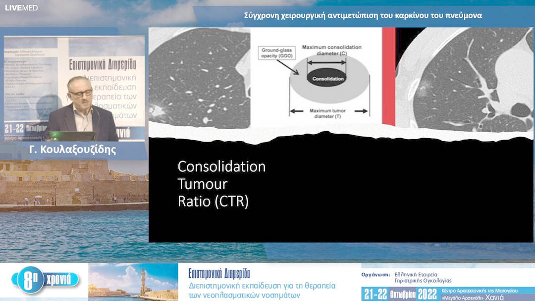 09 Γ. Κουλαξουζίδης - Σύγχρονη χειρουργική αντιμετώπιση του καρκίνου του πνεύμονα 