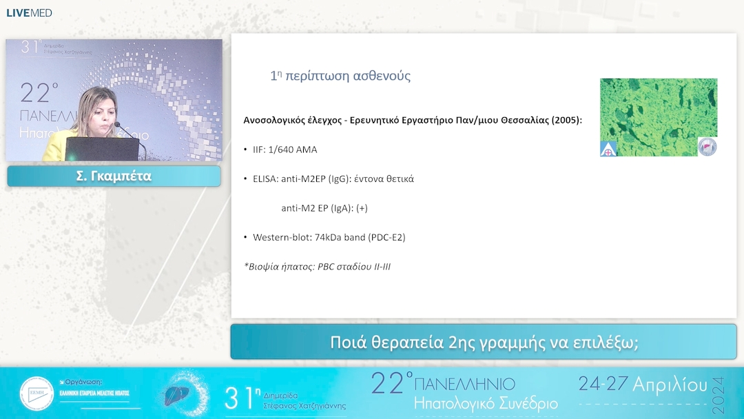 02 Σ. Γκαμπέτα - Ποιά θεραπεία 2ης γραμμής να επιλέξω;