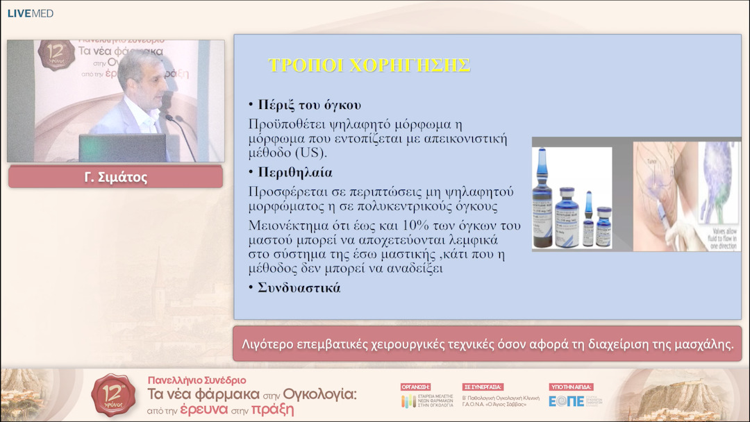 43 Γ. Σιμάτος - Λιγότερο επεμβατικές χειρουργικές τεχνικές όσον αφορά τη διαχείριση της μασχάλης. 