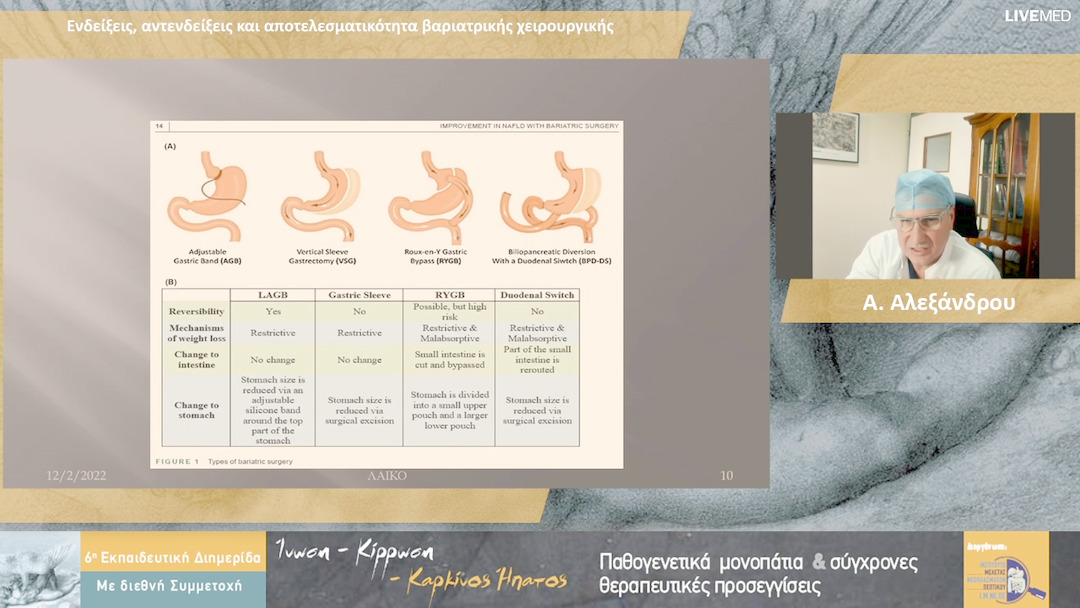 10 Α. Αλεξάνδρου - Ενδείξεις, αντενδείξεις και αποτελεσματικότητα βαριατρικής χειρουργικής 