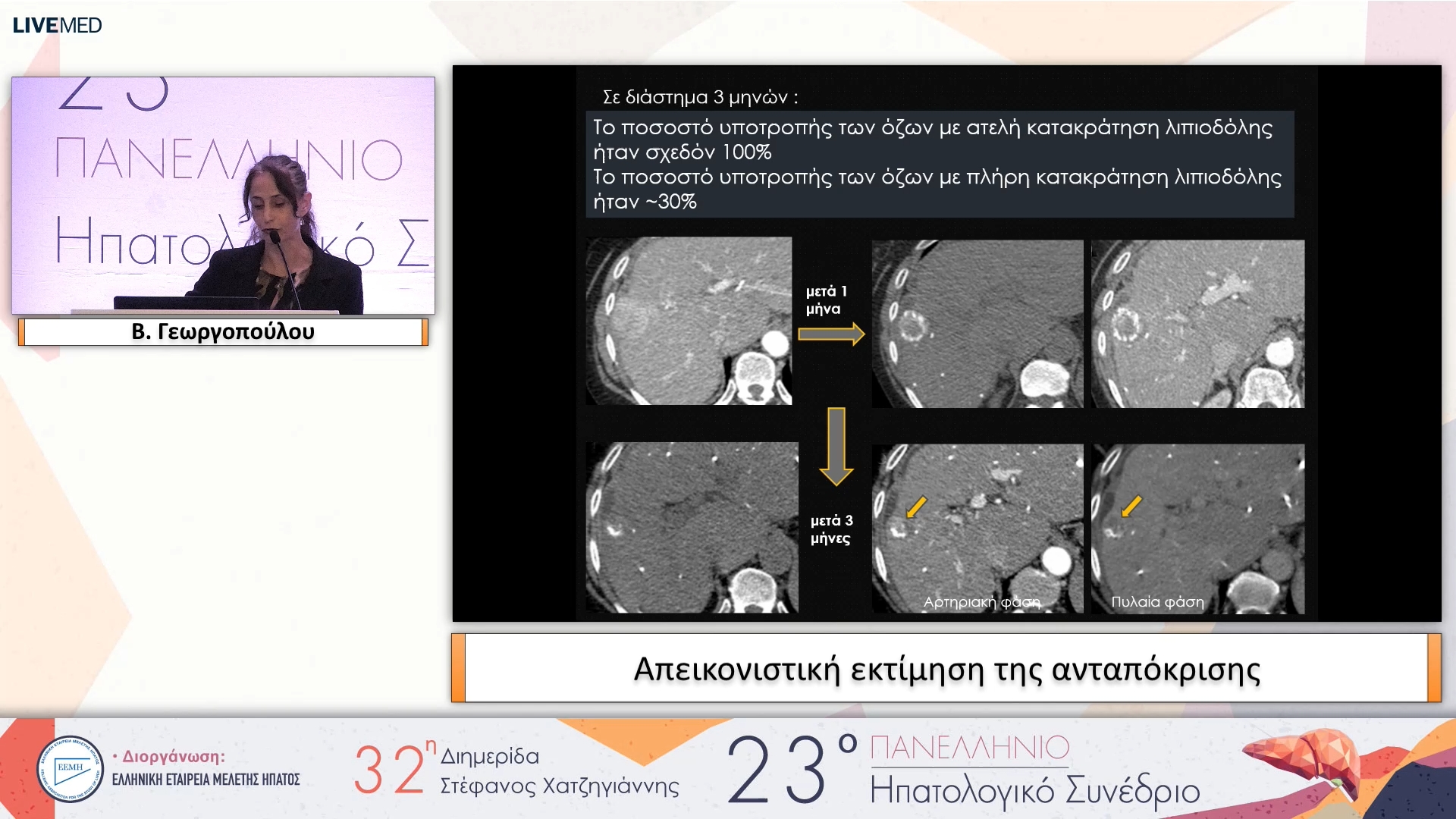 064 Β. Γεωργοπούλου - Απεικονιστική εκτίμηση της ανταπόκρισης