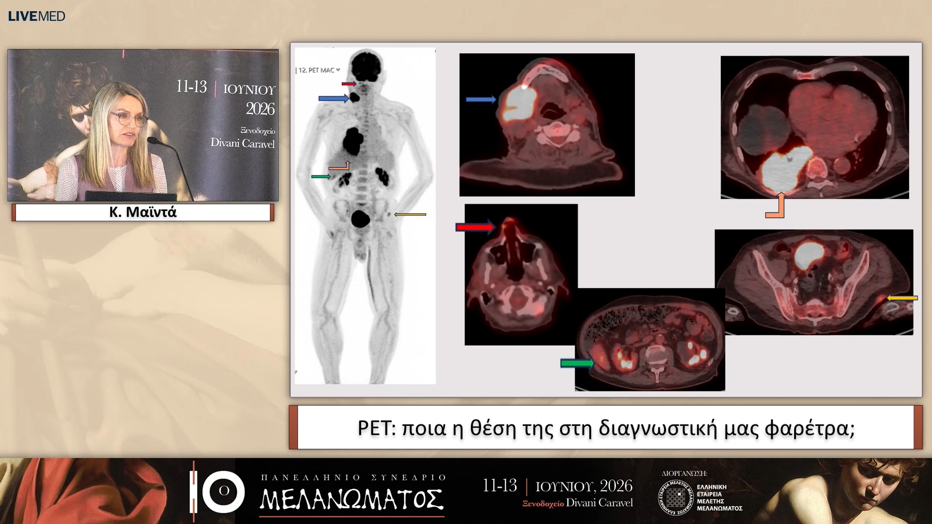 07 Κ. Μαϊντά - PET: ποια η θέση της στη διαγνωστική μας φαρέτρα; 