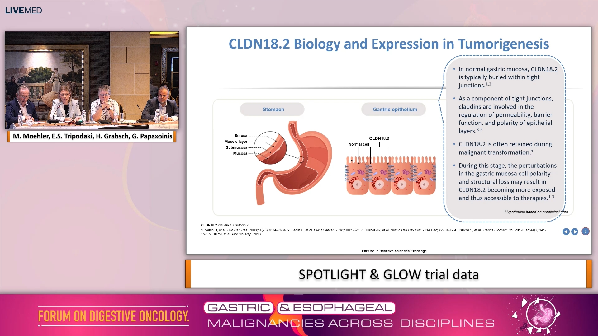 18 Case12: CLDN18.2-Targeted Therapy in Metastatic Gastric Cancer
