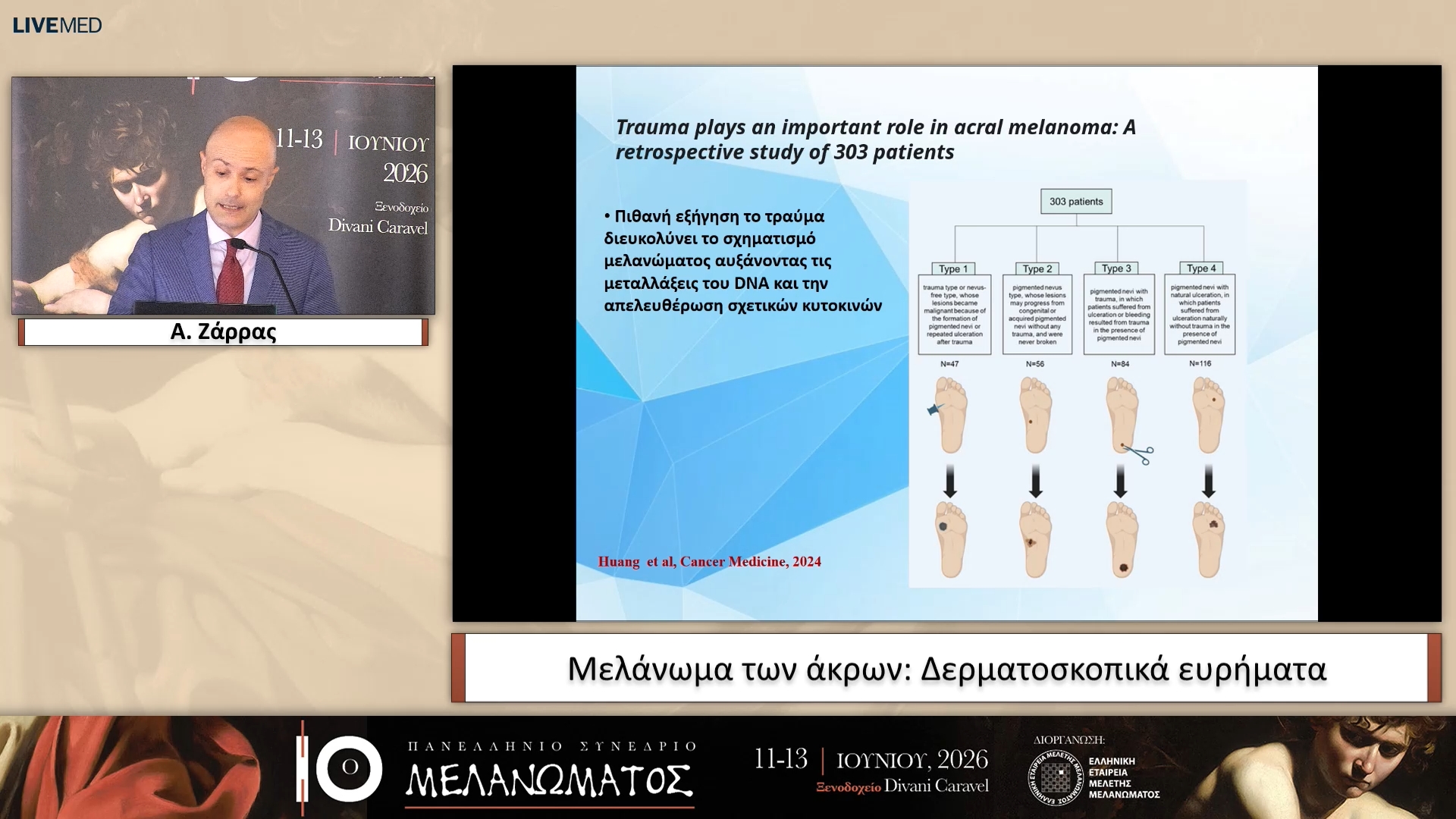 12 Α. Ζάρρας - Μελάνωμα των άκρων: Δερματοσκοπικά ευρήματα 