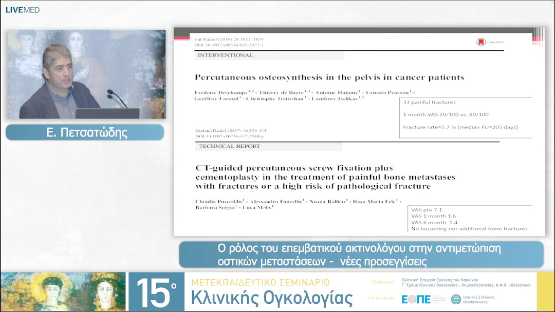 03 Ε. Πετσατώδης - Ο ρόλος του επεμβατικού ακτινολόγου στην αντιμετώπιση  οστικών μεταστάσεων - νέες προσεγγίσεις. 