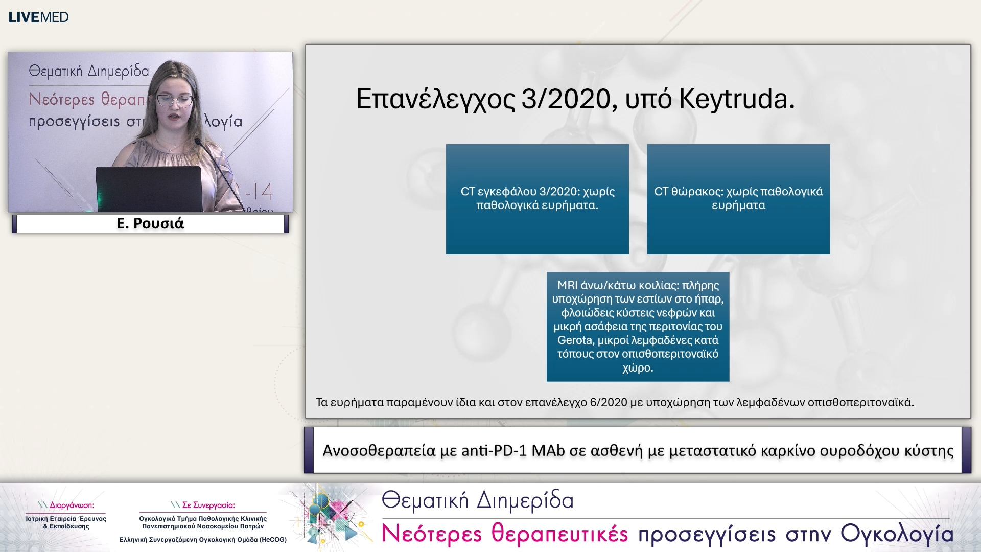 03 Ε. Ρούσια - Ανοσοθεραπεία με anti-PD-1 MAb σε ασθενή με μεταστατικό καρκίνο ουροδόχου κύστης