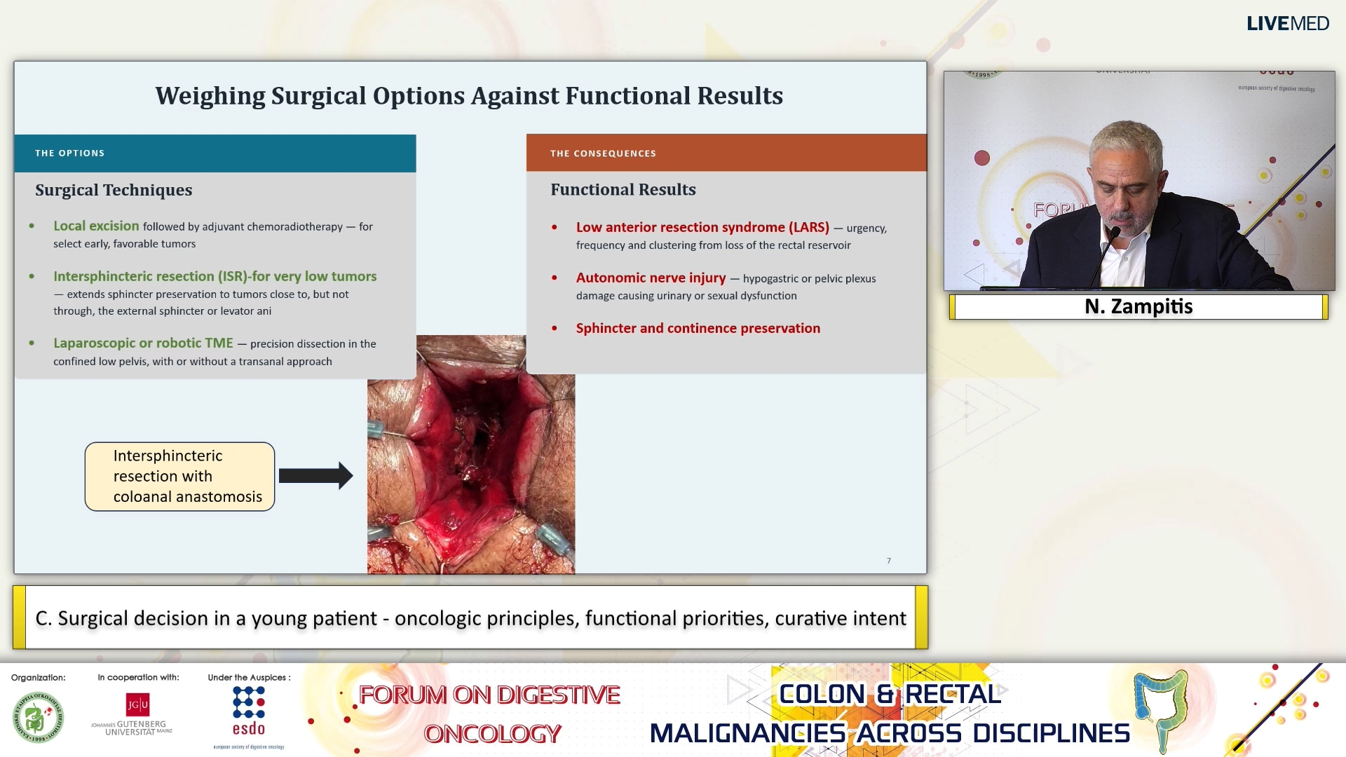 04 N. Zampitis - C. Surgical decision in a young patient - oncologic principles, functional priorities, curative intent. 