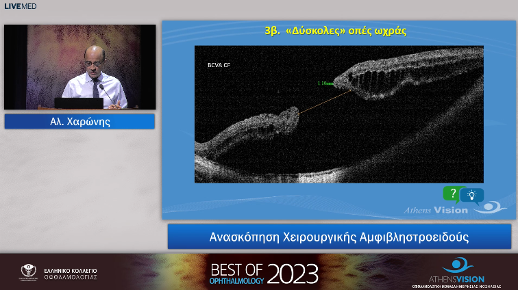 16 Αλ. Χαρώνης - Ανασκόπηση Χειρουργικής Αμφιβληστροειδούς 