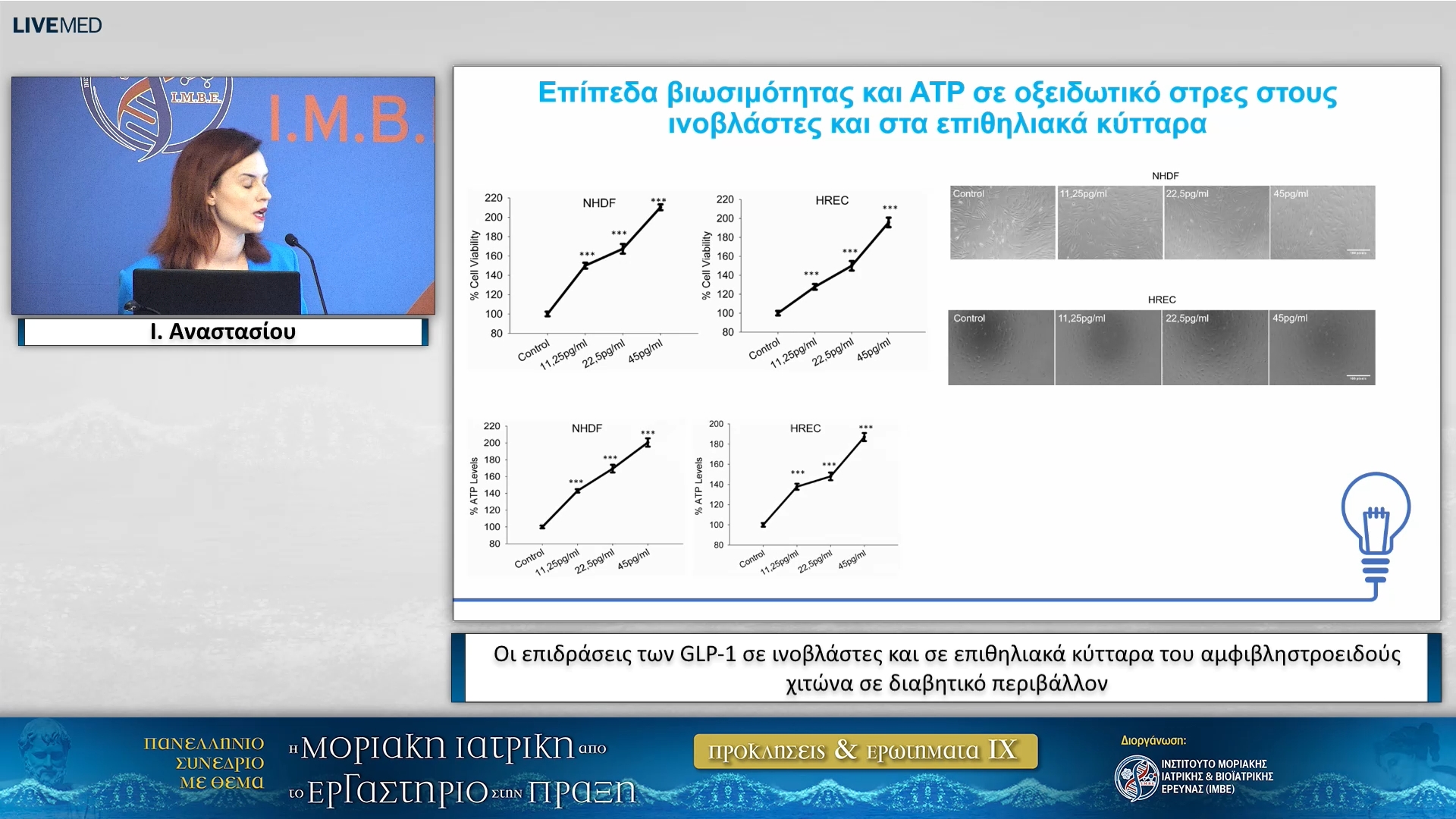 13  Ι. Αναστασίου - Οι επιδράσεις των GLP-1 σε ινοβλάστες και σε επιθηλιακά κύτταρα του αμφιβληστροειδούς χιτώνα σε διαβητικό περιβάλλον