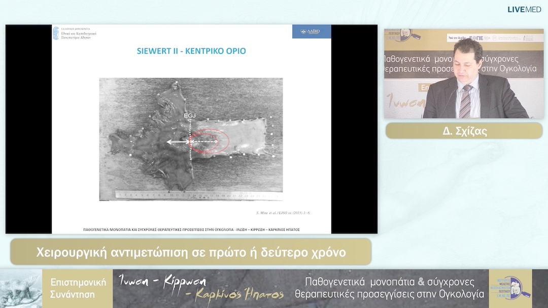 10 Δ. Σχίζας - Χειρουργική αντιμετώπιση σε πρώτο ή δεύτερο χρόνο 