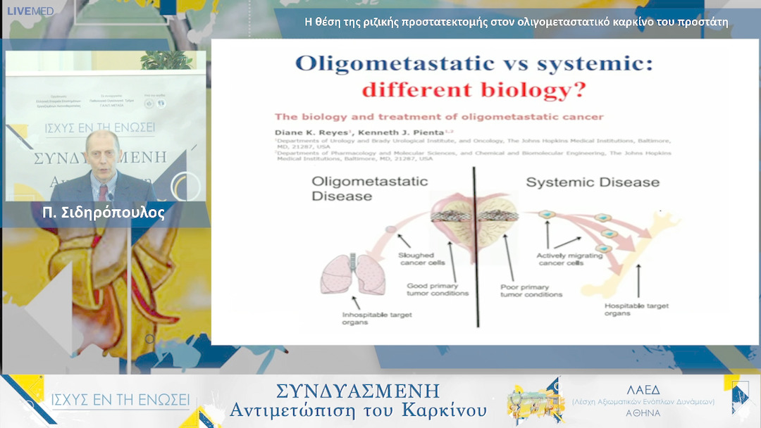 18 Π. Σιδηρόπουλος - Η θέση της ριζικής προστατεκτομής στον ολιγομεταστατικό καρκίνο του προστάτη 