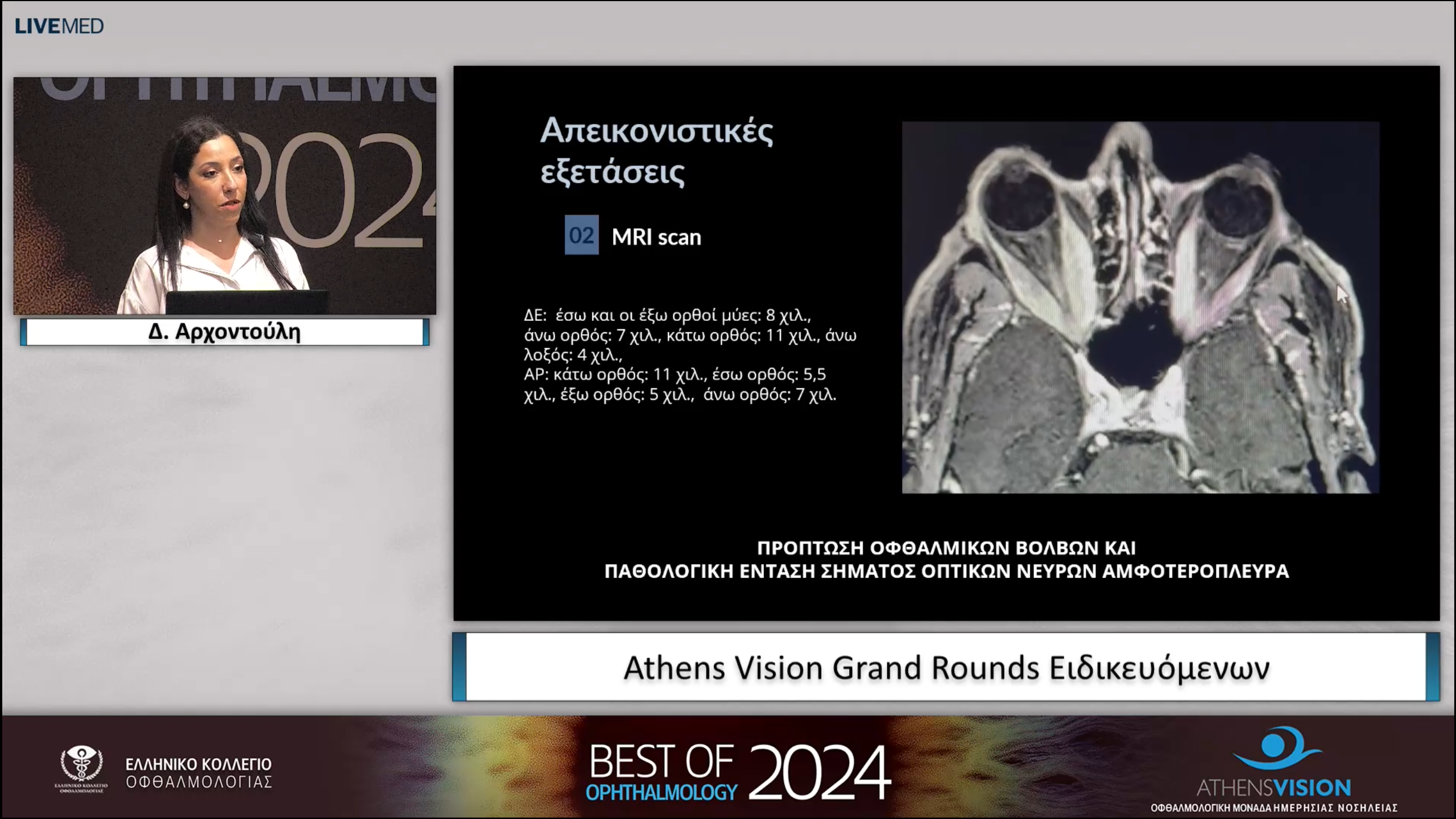 11 Δ. Αρχοντούλη - Athens Vision Grand Rounds Ειδικευόμενων