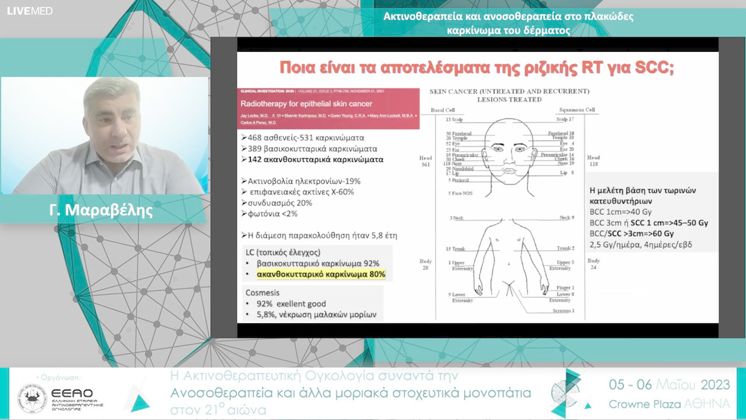 14  Γ. Μαραβέλης - Ακτινοθεραπεία και ανοσοθεραπεία στο πλακώδες καρκίνωμα του δέρματος 