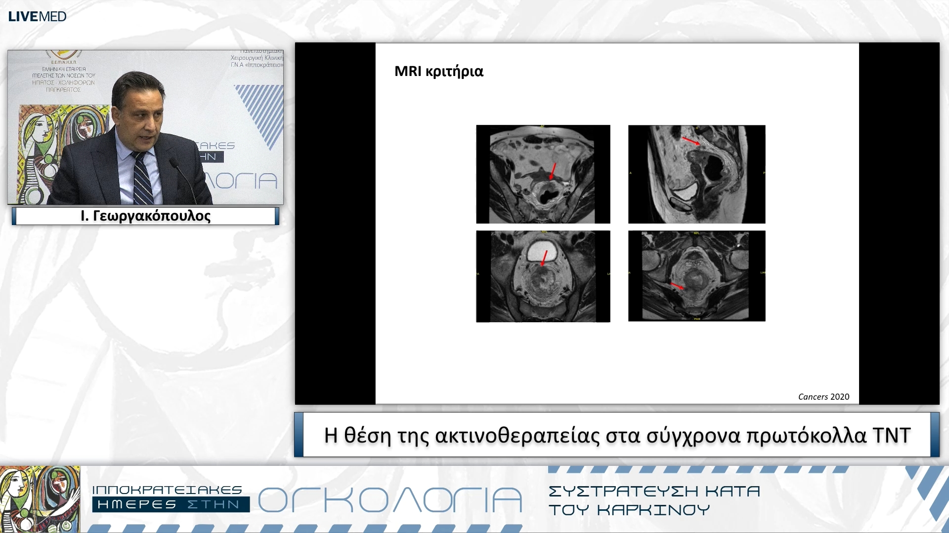 42 Ι. Γεωργακόπουλος - Η θέση της ακτινοθεραπείας στα σύγχρονα πρωτόκολλα ΤΝΤ