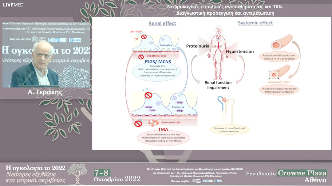 02 Α. Γεράκης - Νεφρολογικές επιπλοκές ανοσοθεραπείας και ΤΚΙs. Διαγνωστική προσέγγιση και αντιμετώπιση
