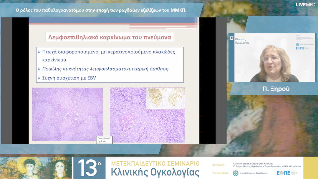 14 Π. Ξηρού - Ο ρόλος του παθολογοανατόμου στην εποχή των ραγδαίων εξελίξεων του ΜΜΚΠ. 