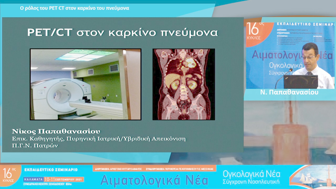 09 Ν. Παπαθανασίου - Ο ρόλος του PET CT στον καρκίνο του πνεύμονα