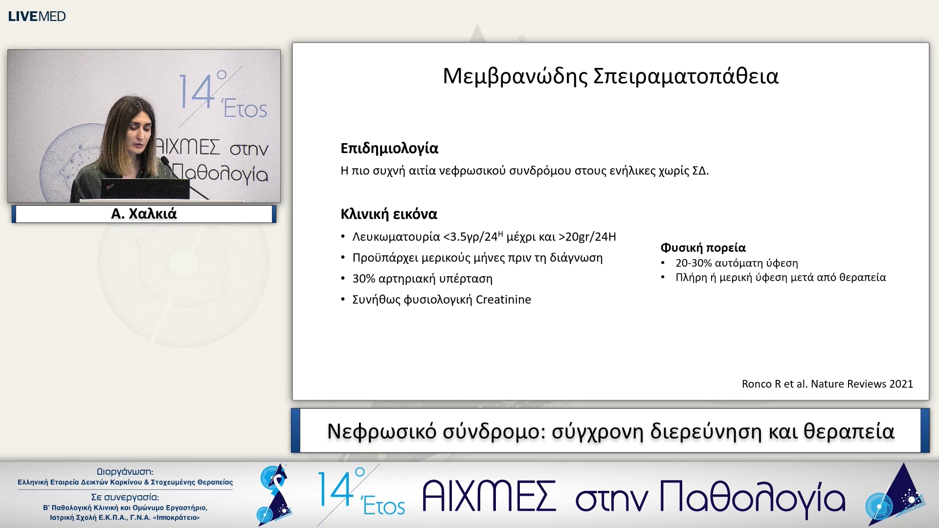 18 Α. Χαλκιά - Νεφρωσικό σύνδρομο: σύγχρονη διερεύνηση και θεραπεία