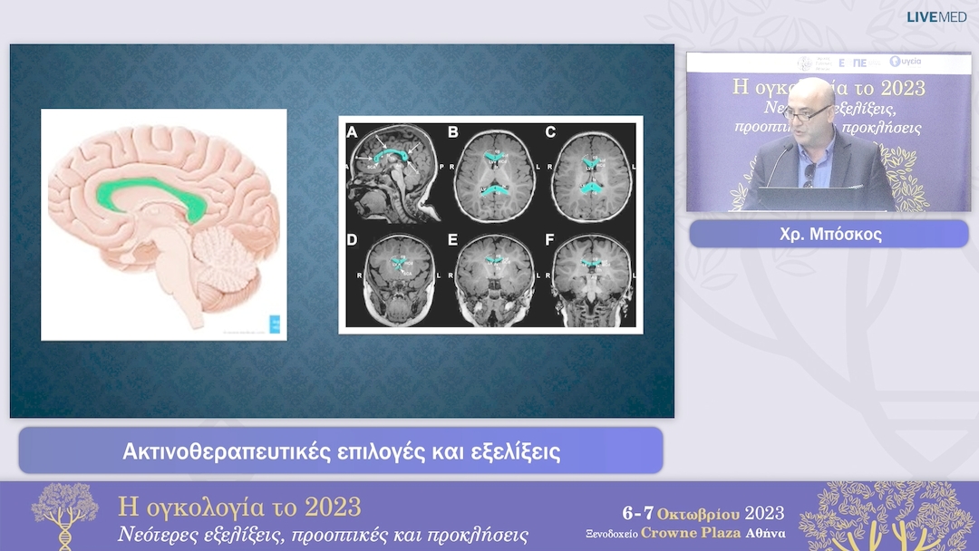 06 Χρ. Μπόσκος - Ακτινοθεραπευτικές επιλογές και εξελίξεις