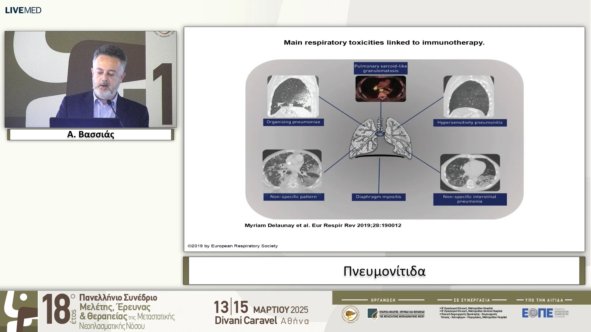 17 A. Βασσιάς - Πνευμονίτιδα