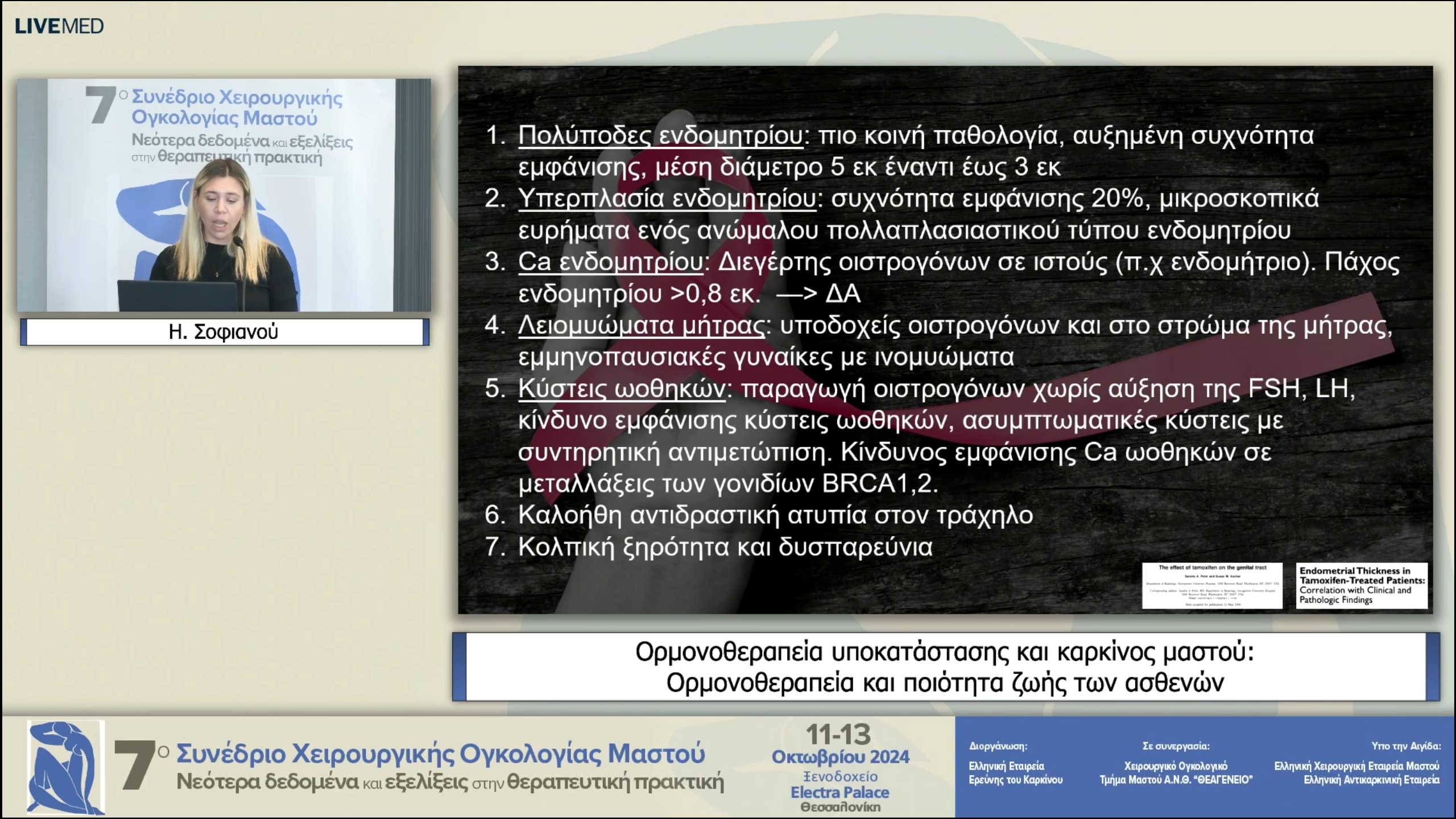 47 Η. Σοφιανού - Ορμονοθεραπεία και ποιότητα ζωής των ασθενών