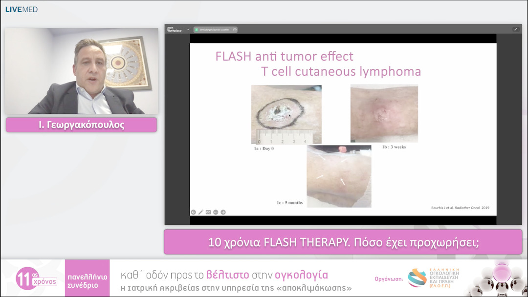 06 Ι. Γεωργακόπουλος - 10 χρόνια FLASH THERAPY. Πόσο έχει προχωρήσει;