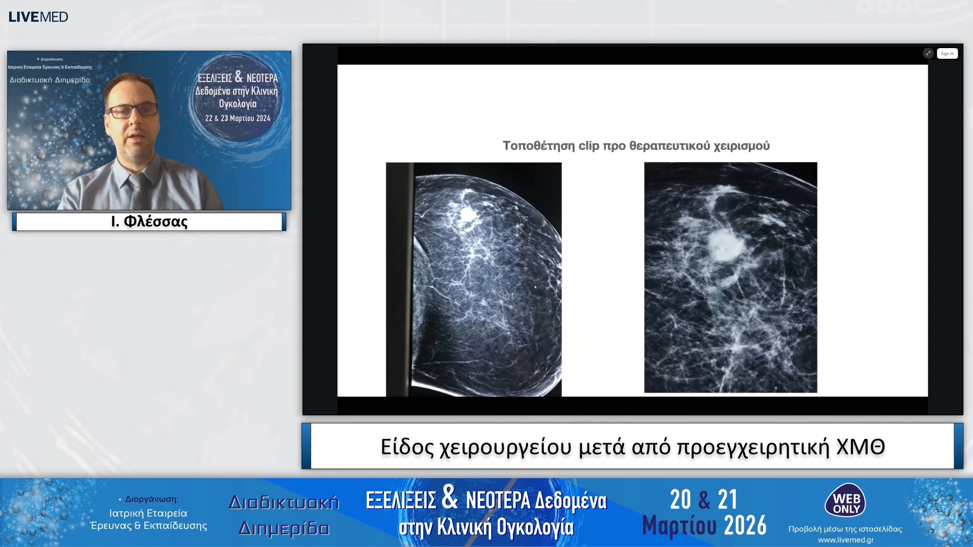 23 Ι. Φλέσσας - Είδος χειρουργείου μετά από προεγχειρητική ΧΜΘ