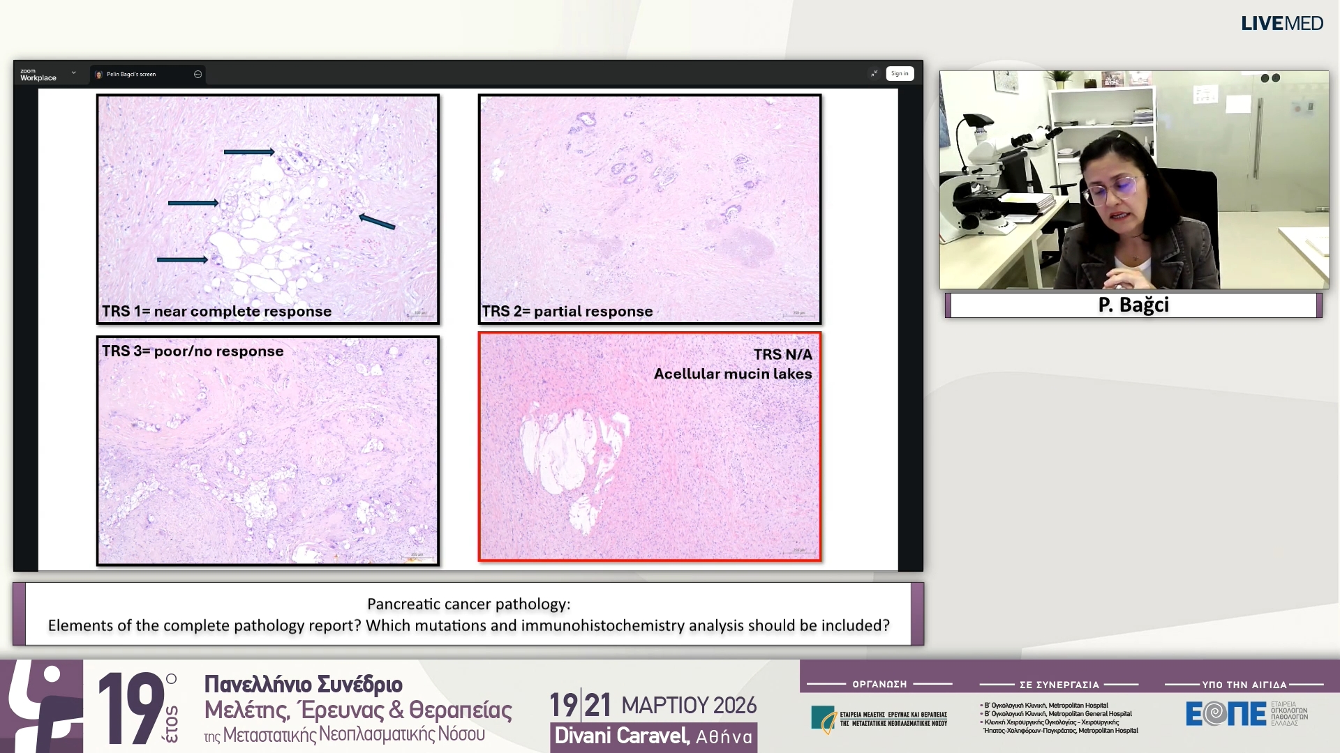 15 P. Bağci - Pancreatic cancer pathology: Elements of the complete pathology report? Which mutations and immunohistochemistry analysis should be included?