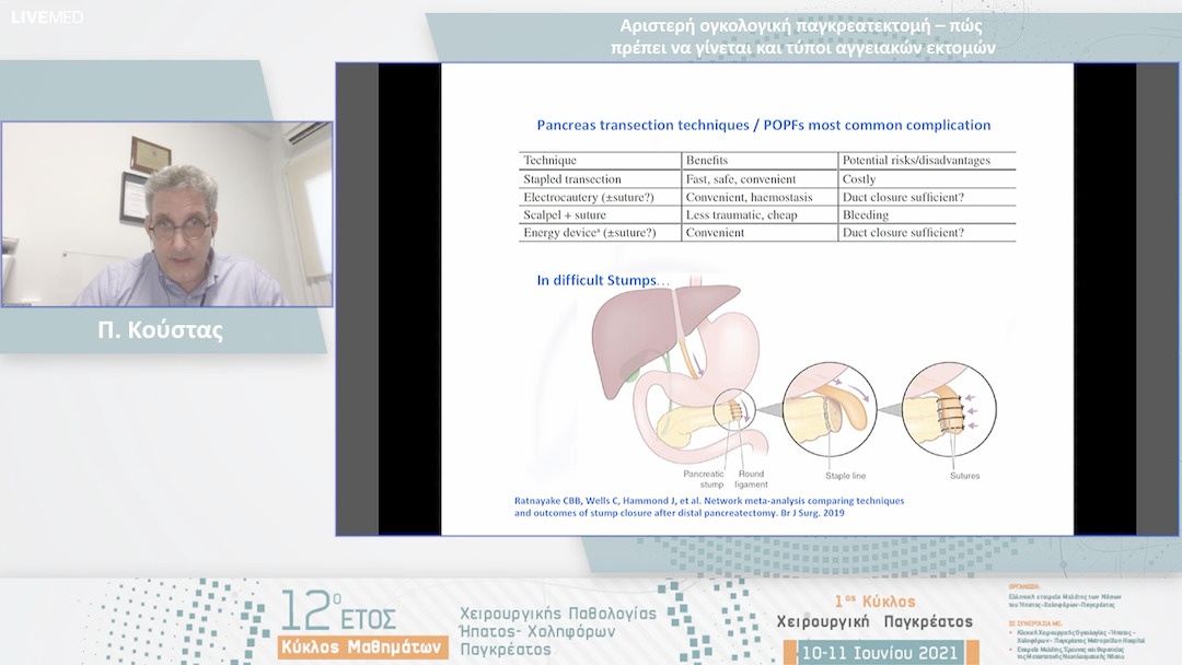 15 Π. Κούστας - Αριστερή ογκολογική παγκρεατεκτομή – πώς πρέπει να γίνεται και τύποι αγγειακών εκτομών 