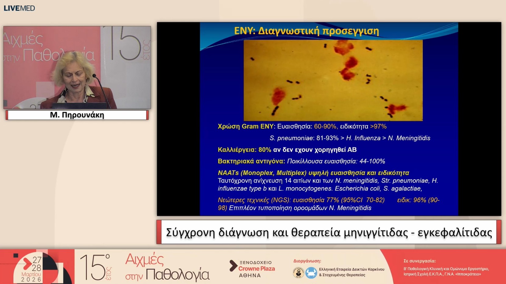 57 Μ. Πηρουνάκη - Σύγχρονη διάγνωση και θεραπεία μηνιγγίτιδας - εγκεφαλίτιδας