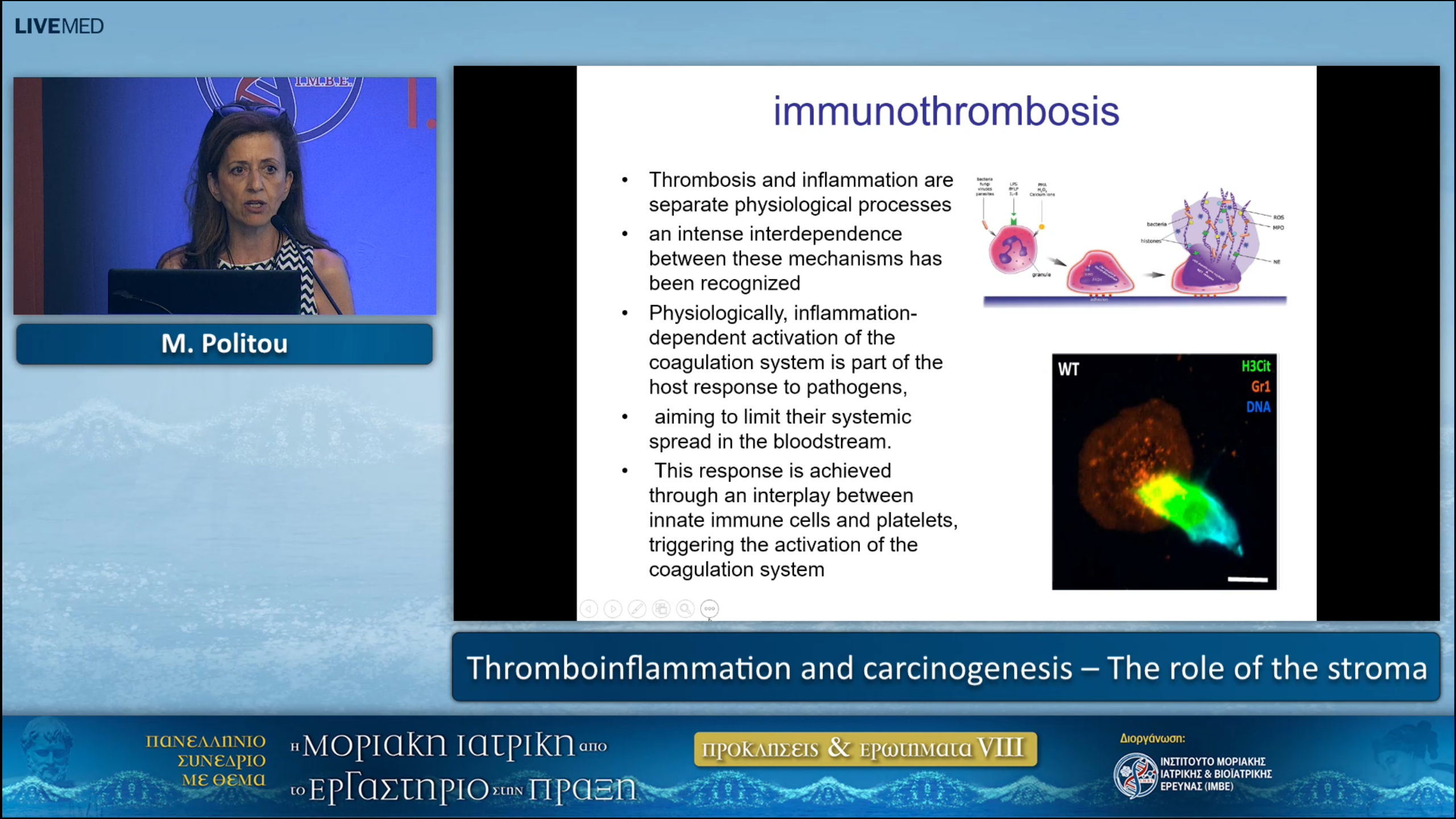 20 M. Politou - Thromboinflammation and carcinogenesis – The role of the stroma 