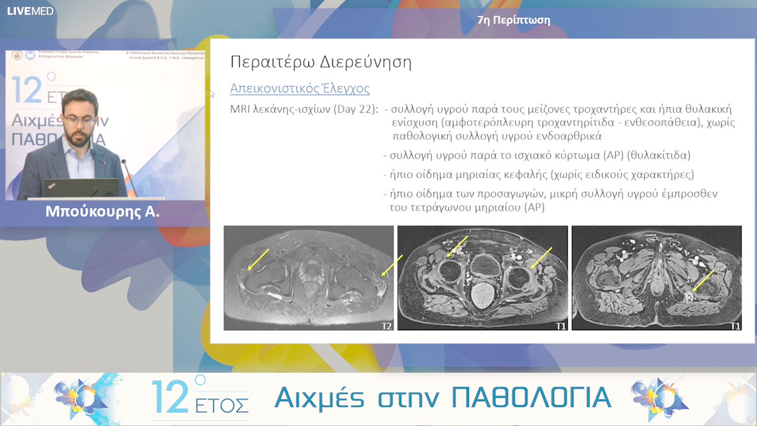 07 Μπούκουρης Α. - 7η Περίπτωση