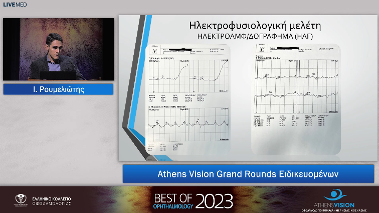 06 Ι. Ρουμελιώτης - Athens Vision Grand Rounds Ειδικευομένων 