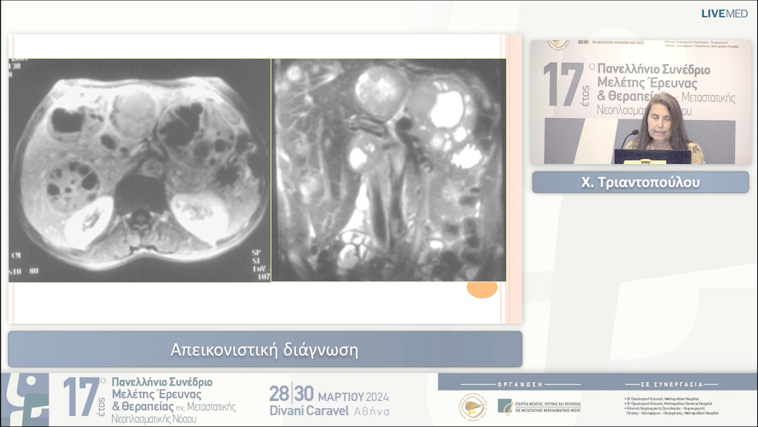 09 Χ. Τριαντοπούλου - Απεικονιστική διάγνωση 