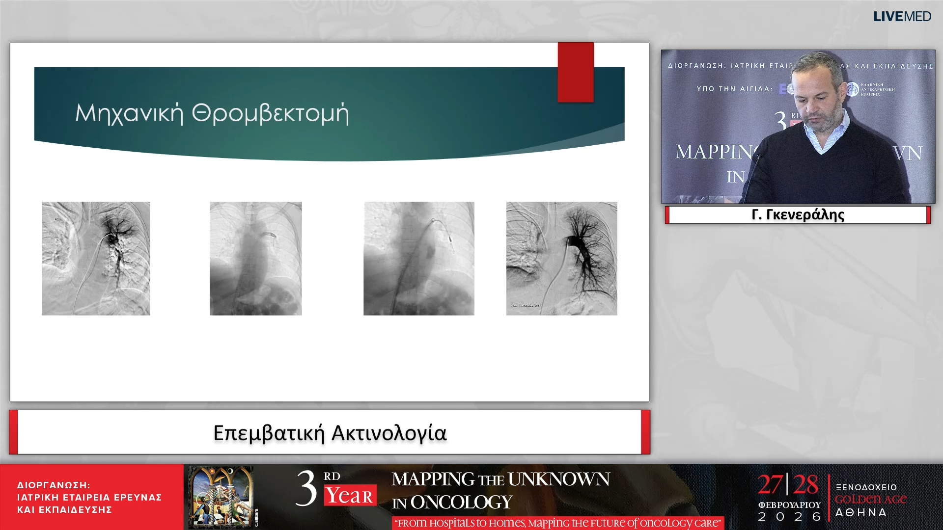 47 Γ. Γκενεράλης - Επεμβατική Ακτινολογία 