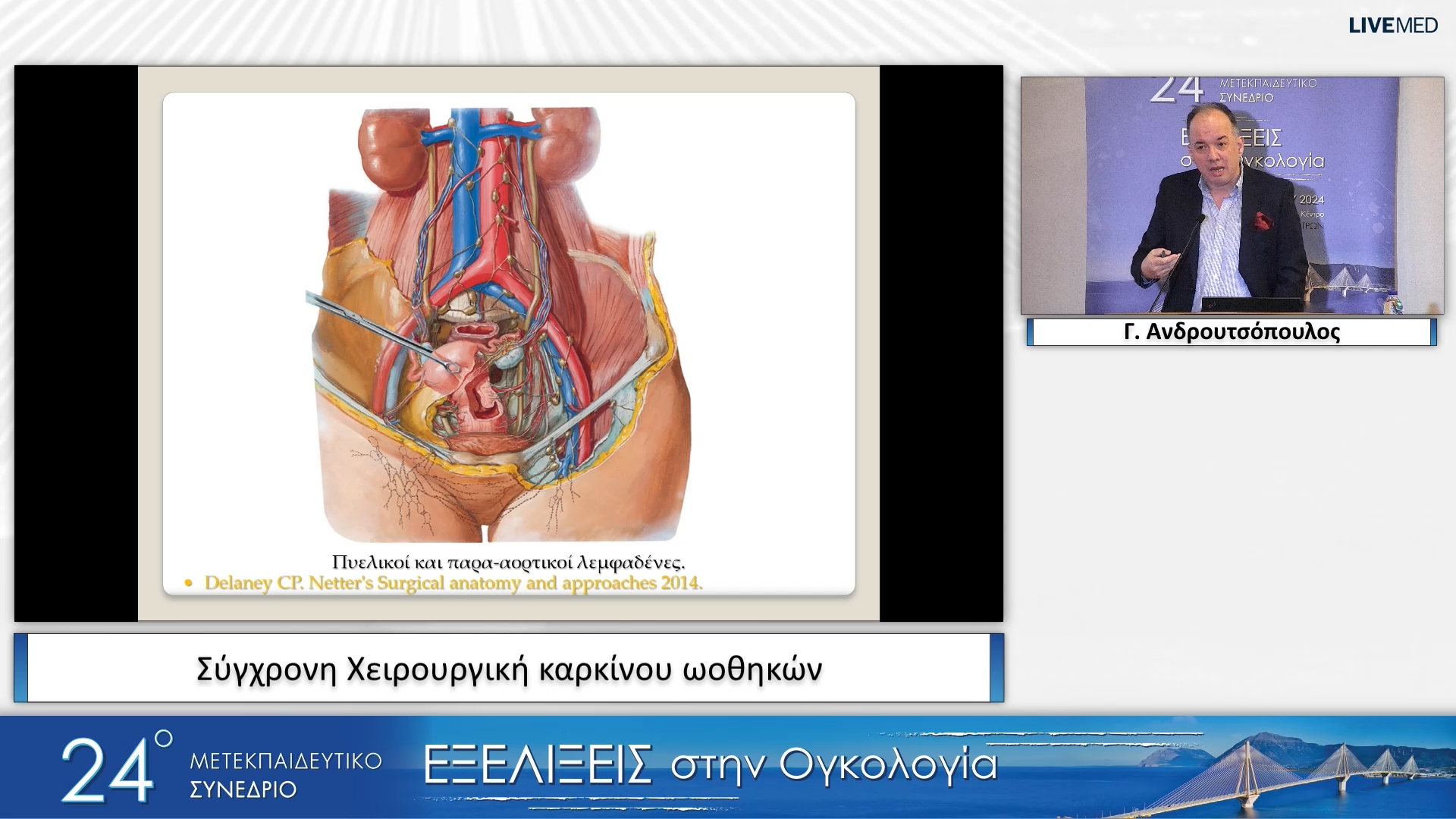 02 Γ. Ανδρουτσόπουλος - Σύγχρονη Χειρουργική καρκίνου ωοθηκών 