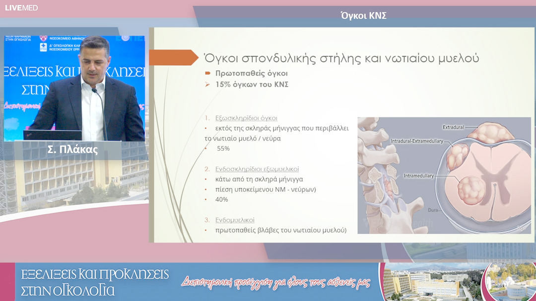 11 Σ. Πλάκας - Όγκοι ΚΝΣ