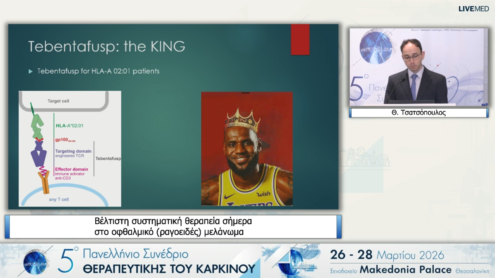 48 Θ. Τσατσόπουλος - Βέλτιστη συστηματική θεραπεία σήμερα στο οφθαλμικό (ραγοειδές) μελάνωμα