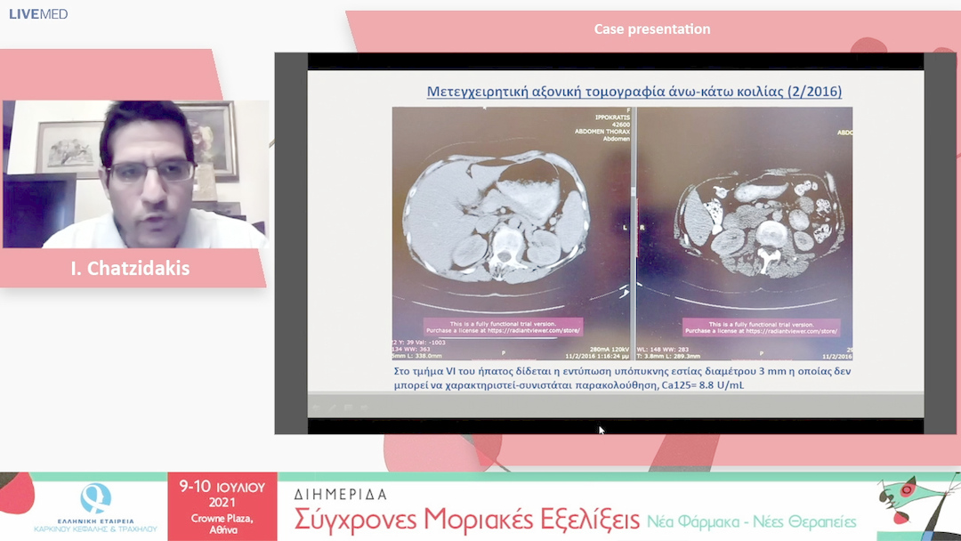 26 I. Chatzidakis - Case presentation