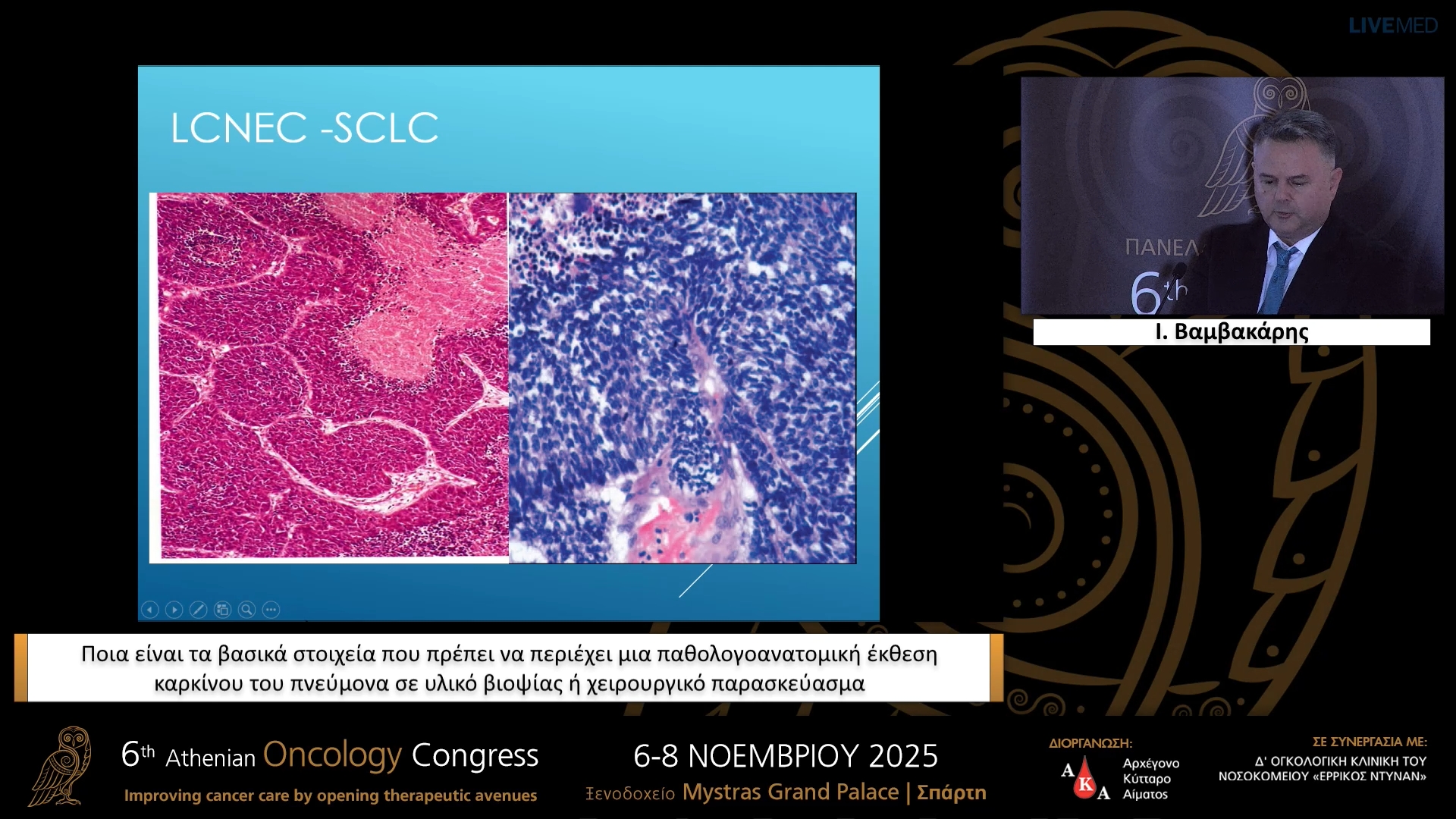 02 Ι. Βαμβακάρης - Ποια είναι τα βασικά στοιχεία που πρέπει να περιέχει μια παθολογοανατομική έκθεση καρκίνου του πνεύμονα σε υλικό βιοψίας ή χειρουργικό παρασκεύασμα.