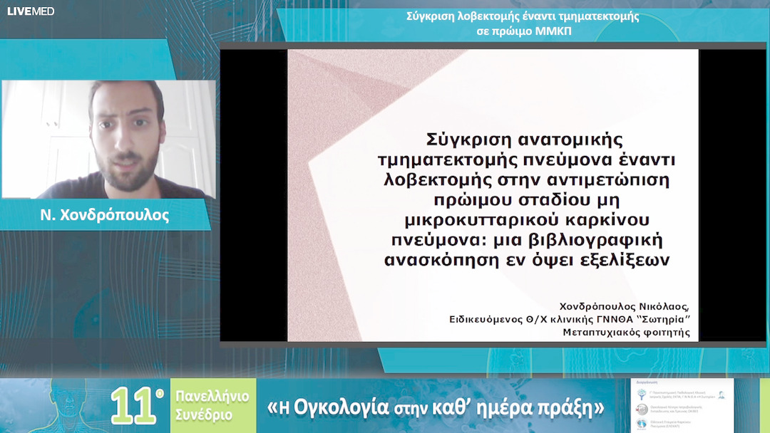21 Ν. Χονδρόπουλος - Σύγκριση λοβεκτομής έναντι τμηματεκτομής σε πρώιμο MMKΠ 