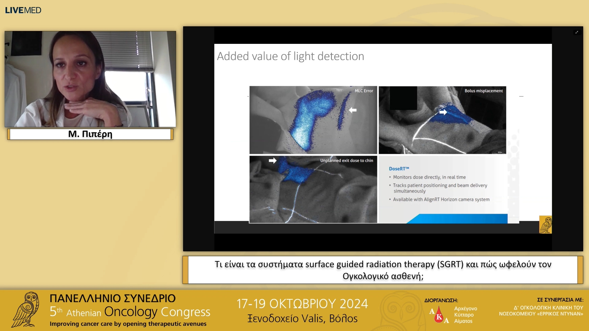 21 Μ. Πιπέρη - Τι είναι τα συστήματα surface guided radiation therapy (SGRT) και πώς ωφελούν τον Ογκολογικό ασθενή; 