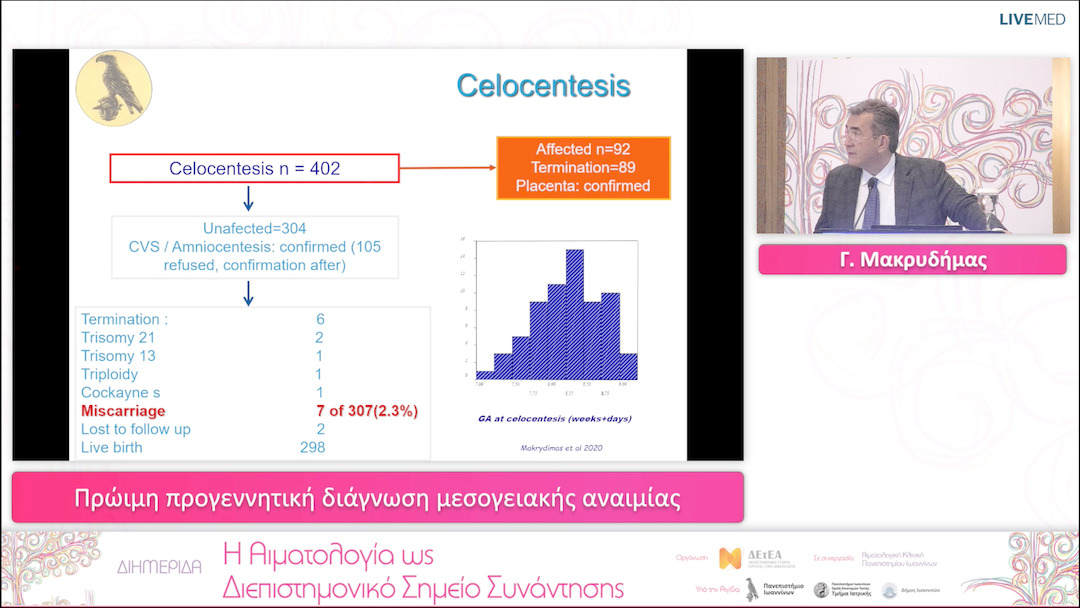 09 Γ. Μακρυδήμας - Πρώιμη προγεννητική διάγνωση μεσογειακής αναιμίας 