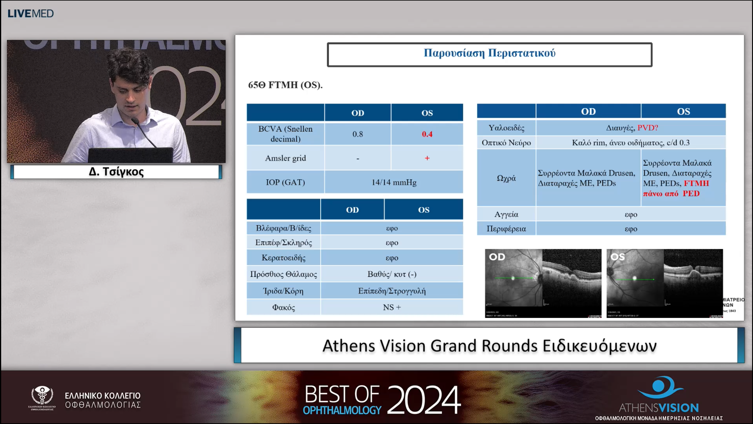 09 Δ. Τσίγκος - Athens Vision Grand Rounds Ειδικευόμενων