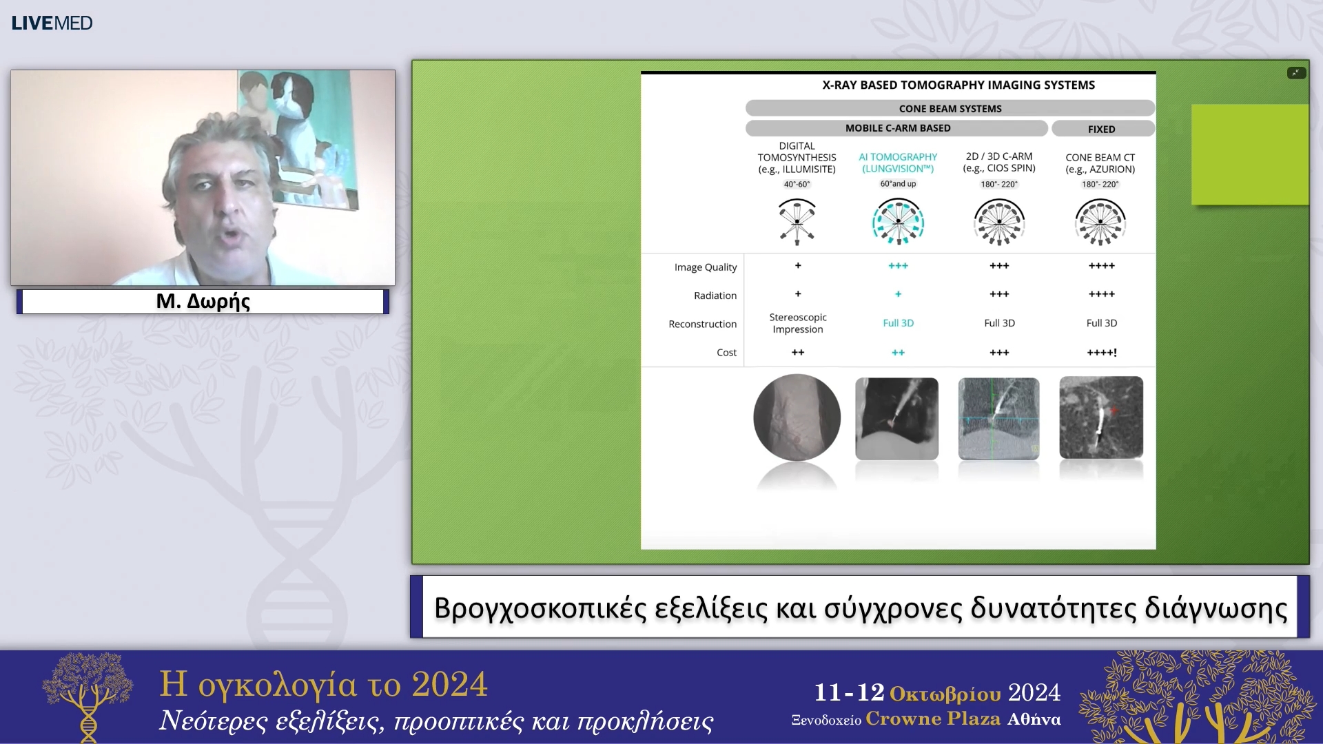 39 Μ. Δωρής - Βρογχοσκοπικές εξελίξεις και σύγχρονες δυνατότητες διάγνωσης 