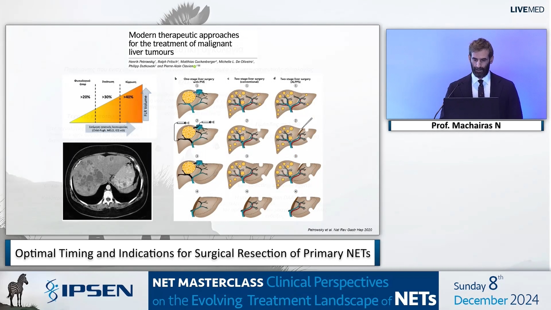 05 Prof. Machairas N. - Optimal Timing and Indications for Surgical Resection of Primary NETs