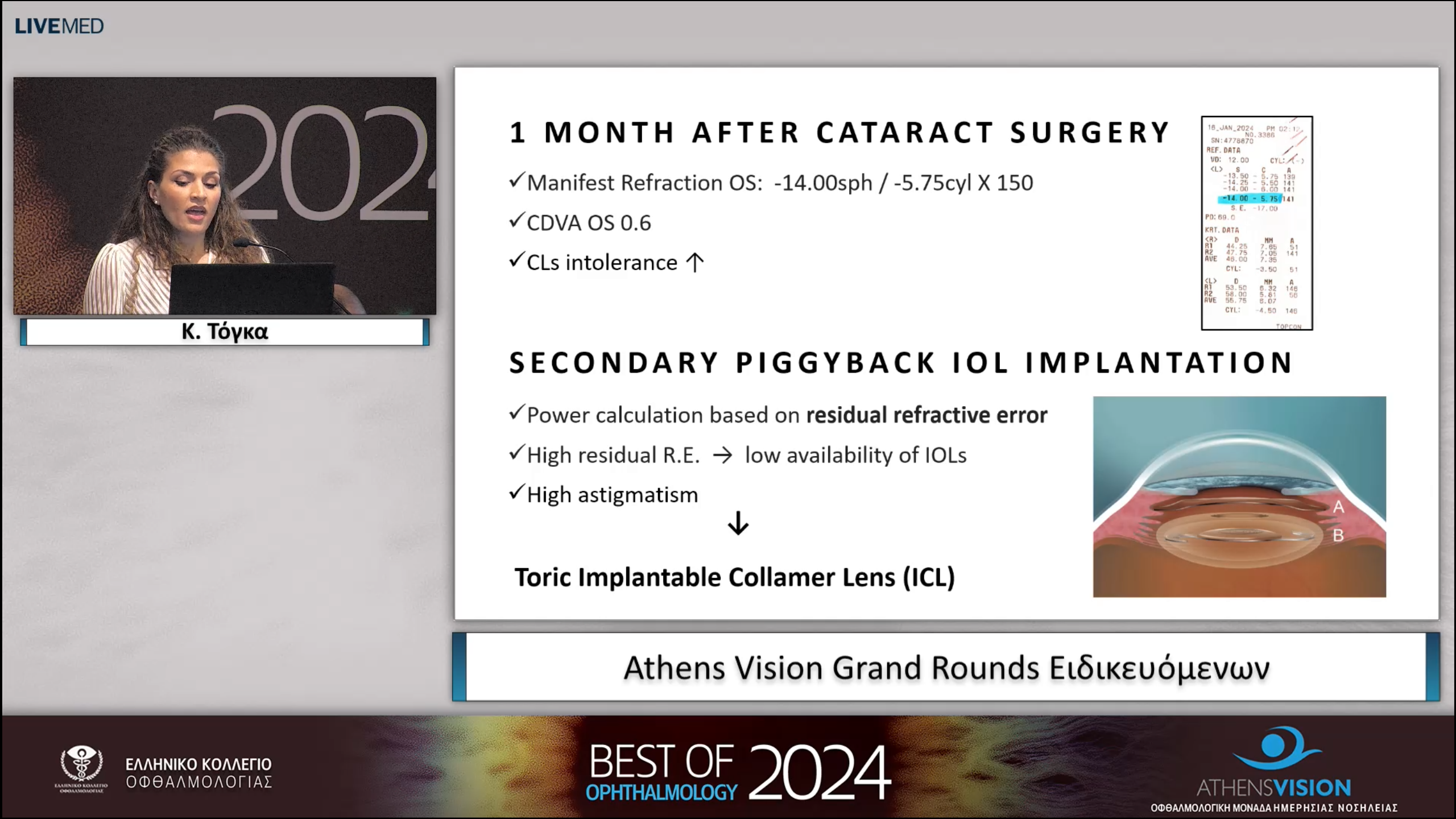 08 Κ. Τόγκα - Athens Vision Grand Rounds Ειδικευόμενων 