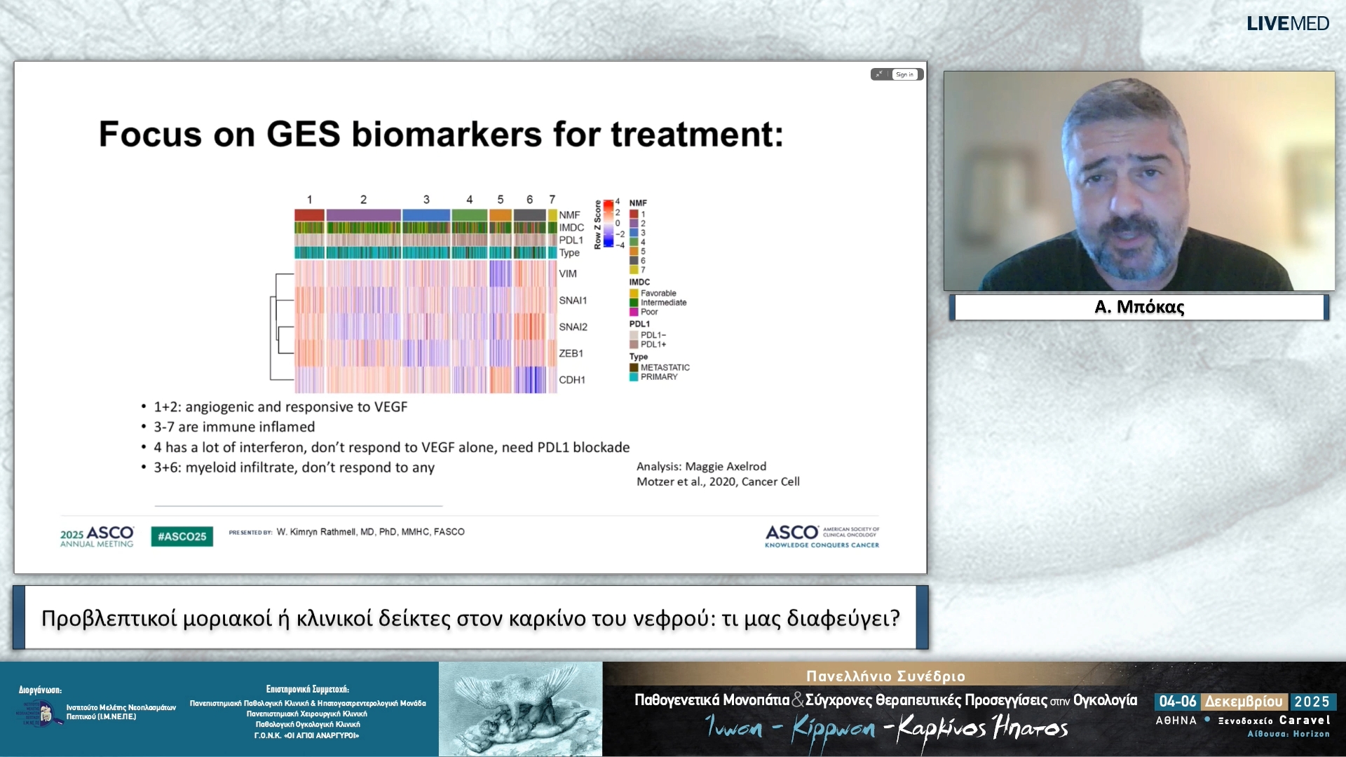 75 Α. Μπόκας - Προβλεπτικοί μοριακοί ή κλινικοί δείκτες στον καρκίνο του νεφρού: τι μας διαφεύγει;
